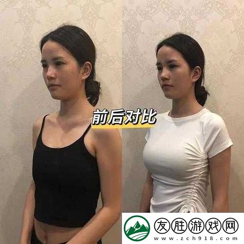 水滴形与圆形丰胸对比：哪种更适合你的美胸追求